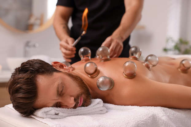 Hijama Cupping Therapy