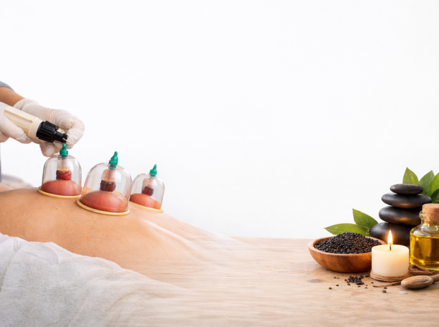 Hijama